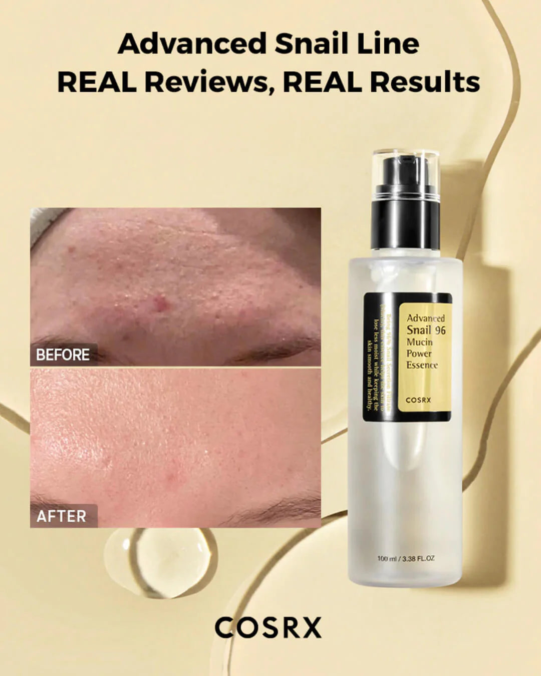 COSRX: Advanced Snail 96 Mucin Power Essence